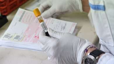 Croatia Counts 208 New COVID-19 Cases in the Last 24 Hours, 5 Being in Dubrovnik-Neretva County 2 covid